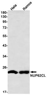 NUP62CL Antibody in Western Blot (WB)