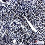hnRNP UL1 Antibody in Immunohistochemistry (Paraffin) (IHC (P))