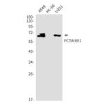 PCTAIRE1 Recombinant Rabbit Monoclonal Antibody (K01_2K72)