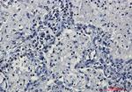 H3K27me3 Antibody in Immunohistochemistry (Paraffin) (IHC (P))