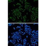 H3K27ac Recombinant Rabbit Monoclonal Antibody (K01_2K75)