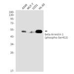 Phospho-beta Arrestin 1 (Ser412) Antibody in Western Blot (WB)