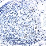 Phospho-CDK1/CDK2 (Thr14) Recombinant Rabbit Monoclonal Antibody (K01_2K81)