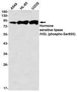 Phospho-HSL (Ser855) Recombinant Rabbit Monoclonal Antibody (K01_2K96)