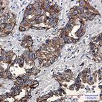 Phospho-Moesin (Thr558) Recombinant Rabbit Monoclonal Antibody (K01_2L03)