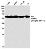 Phospho-Moesin (Thr558) Antibody in Western Blot (WB)