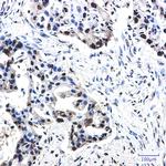 Phospho-NPM1 (Thr199) Recombinant Rabbit Monoclonal Antibody (K01_2L04)