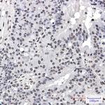 Phospho-PML (Ser518) Recombinant Rabbit Monoclonal Antibody (K01_2L08)