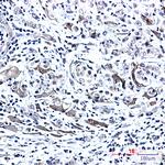 Phospho-PTS (Ser19) Recombinant Rabbit Monoclonal Antibody (K01_2L10)
