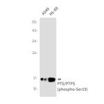 Phospho-PTS (Ser19) Antibody in Western Blot (WB)
