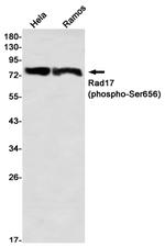 Phospho-RAD17 (Ser656) Antibody in Western Blot (WB)