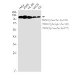 Phospho-TAOK1/TAOK2/TAOK3 (Ser181, Ser177) Antibody in Western Blot (WB)