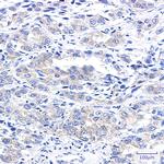 A-Raf Recombinant Rabbit Monoclonal Antibody (K01_2L24)