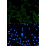 ACADM Recombinant Rabbit Monoclonal Antibody (K01_2L25)
