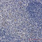 ACADM Antibody in Immunohistochemistry (Paraffin) (IHC (P))