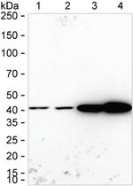 ACADM Antibody in Western Blot (WB)