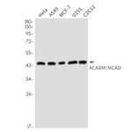 ACADM Antibody in Western Blot (WB)