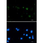Aconitase 2 Recombinant Rabbit Monoclonal Antibody (K01_2L26)