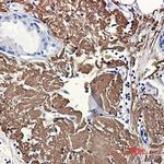Aconitase 2 Antibody in Immunohistochemistry (Paraffin) (IHC (P))