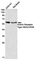 ACVR2B Recombinant Rabbit Monoclonal Antibody (K01_2L28)