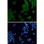 ACTR1B Recombinant Rabbit Monoclonal Antibody (K01_2L30)