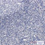 ADK Recombinant Rabbit Monoclonal Antibody (K01_2L31)