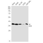 ADK Antibody in Western Blot (WB)