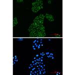 Adenylate Kinase 2 Antibody in Immunocytochemistry (ICC/IF)