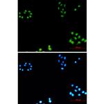 AKAP8 Recombinant Rabbit Monoclonal Antibody (K01_2L34)