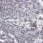 AKAP8 Antibody in Immunohistochemistry (Paraffin) (IHC (P))