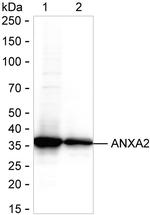 Annexin A2 Recombinant Rabbit Monoclonal Antibody (K01_2L39)