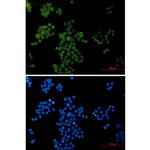 AP2 gamma Recombinant Rabbit Monoclonal Antibody (K01_2L40)
