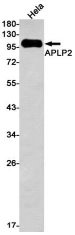 APLP2 Antibody in Western Blot (WB)