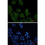 Arp2 Recombinant Rabbit Monoclonal Antibody (K01_2L43)