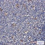 ATP6V1A Recombinant Rabbit Monoclonal Antibody (K01_2L48)