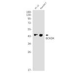 BCKDK Antibody in Western Blot (WB)