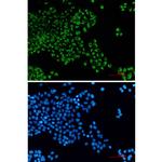 Bcl-G Recombinant Rabbit Monoclonal Antibody (K01_2L52)