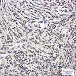 BCR Recombinant Rabbit Monoclonal Antibody (K01_2L53)