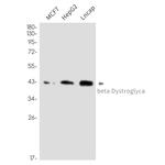 beta Dystroglycan Antibody in Western Blot (WB)