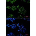 BID Recombinant Rabbit Monoclonal Antibody (K01_2L56)
