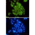 BUBR1 Recombinant Rabbit Monoclonal Antibody (K01_2L59)