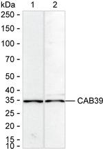 CAB39 Antibody in Western Blot (WB)