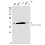 CAB39 Antibody in Western Blot (WB)