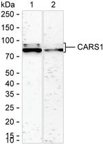CARS Antibody in Western Blot (WB)