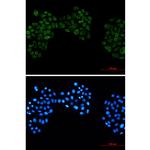 CK2 beta Recombinant Rabbit Monoclonal Antibody (K01_2L67)