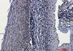 CK2 beta Antibody in Immunohistochemistry (Paraffin) (IHC (P))
