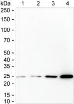 CK2 beta Antibody in Western Blot (WB)