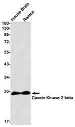 CK2 beta Antibody in Western Blot (WB)