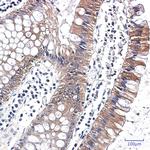 Caspase 7 Recombinant Rabbit Monoclonal Antibody (K01_2L69)