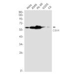 CBX4 Recombinant Rabbit Monoclonal Antibody (K01_2L70)